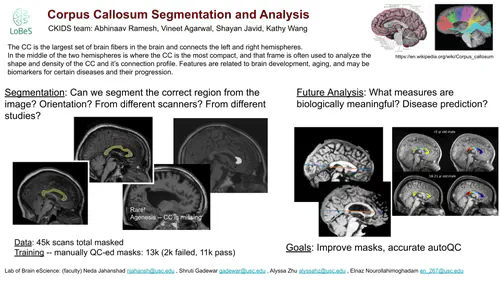 Automatically segmenting and describing the human corpus callosum from brain MRIs